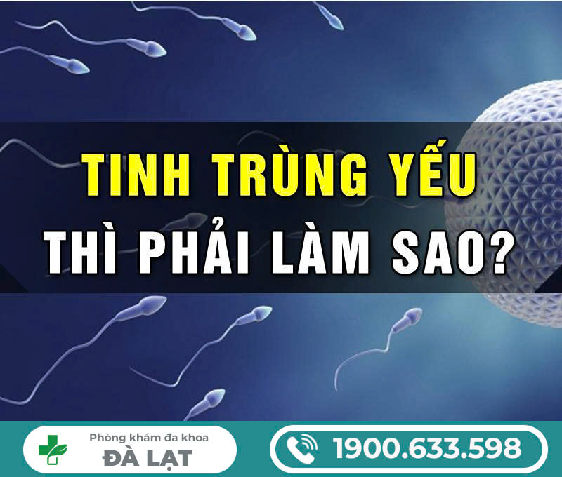 Hình ảnh minh họa